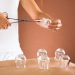 Cupping Therapy: Benefits, Side Effects, And More